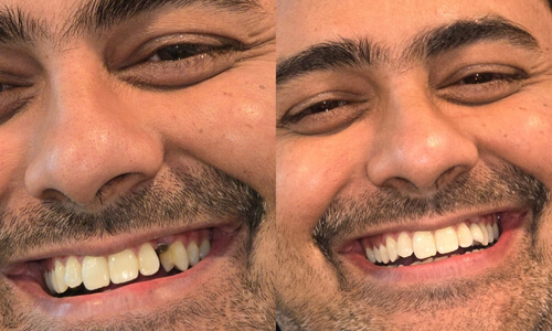 Advanced Implantology