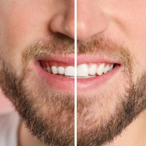 SDAIC - Cosmetic Dentistry