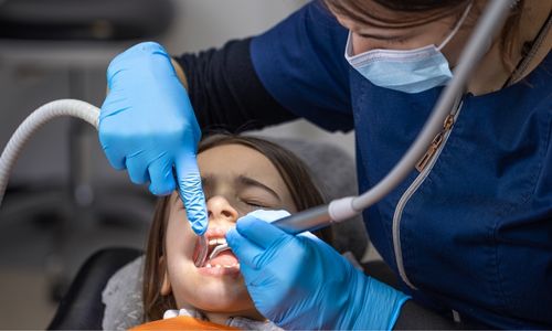 Root Canal Treatment